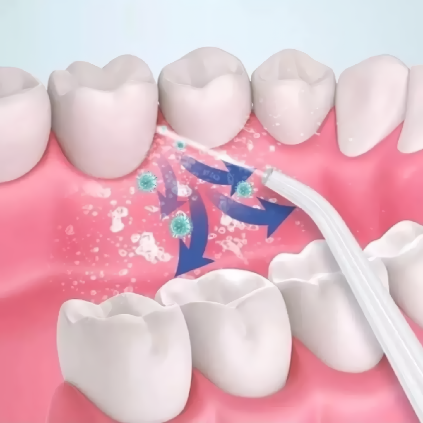Irrigador Oral Portátil